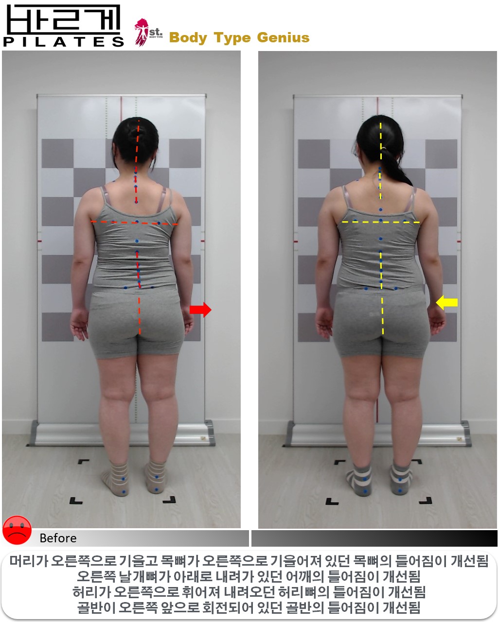 바르게 체형교정운동센터 대표 이미지