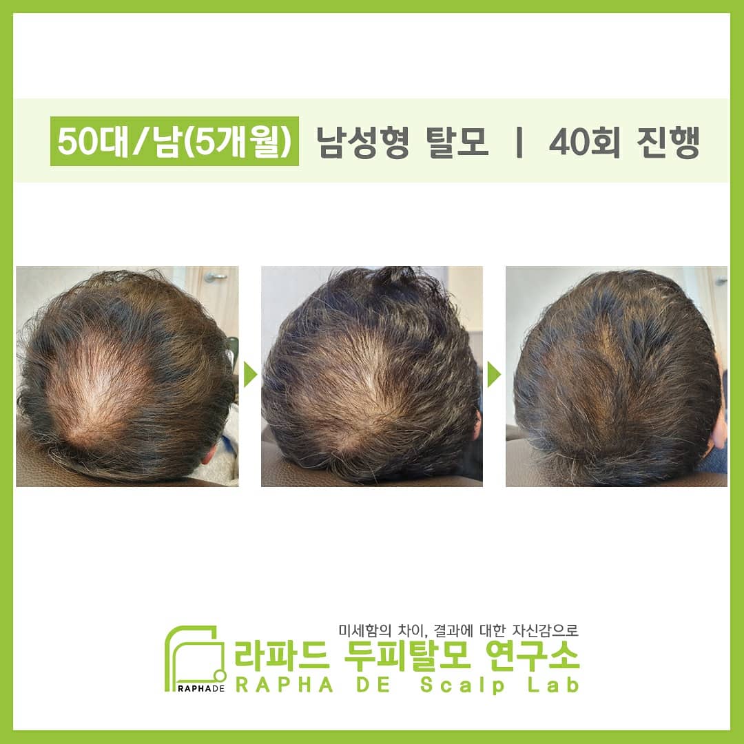 라파드 두피탈모센터 대구본점 대표 이미지