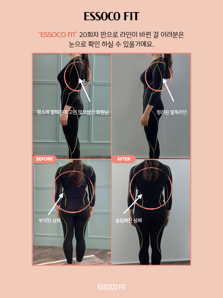 에소코핏 강남구청점