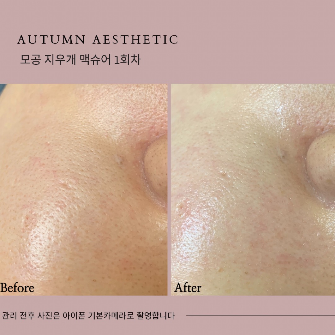 어텀에스테틱 안양범계점 대표 이미지