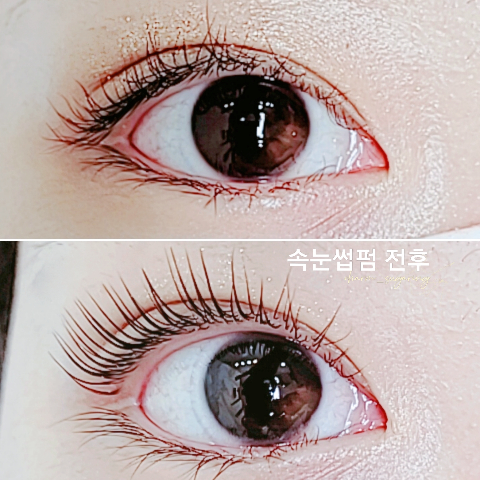 참슈가링왁싱