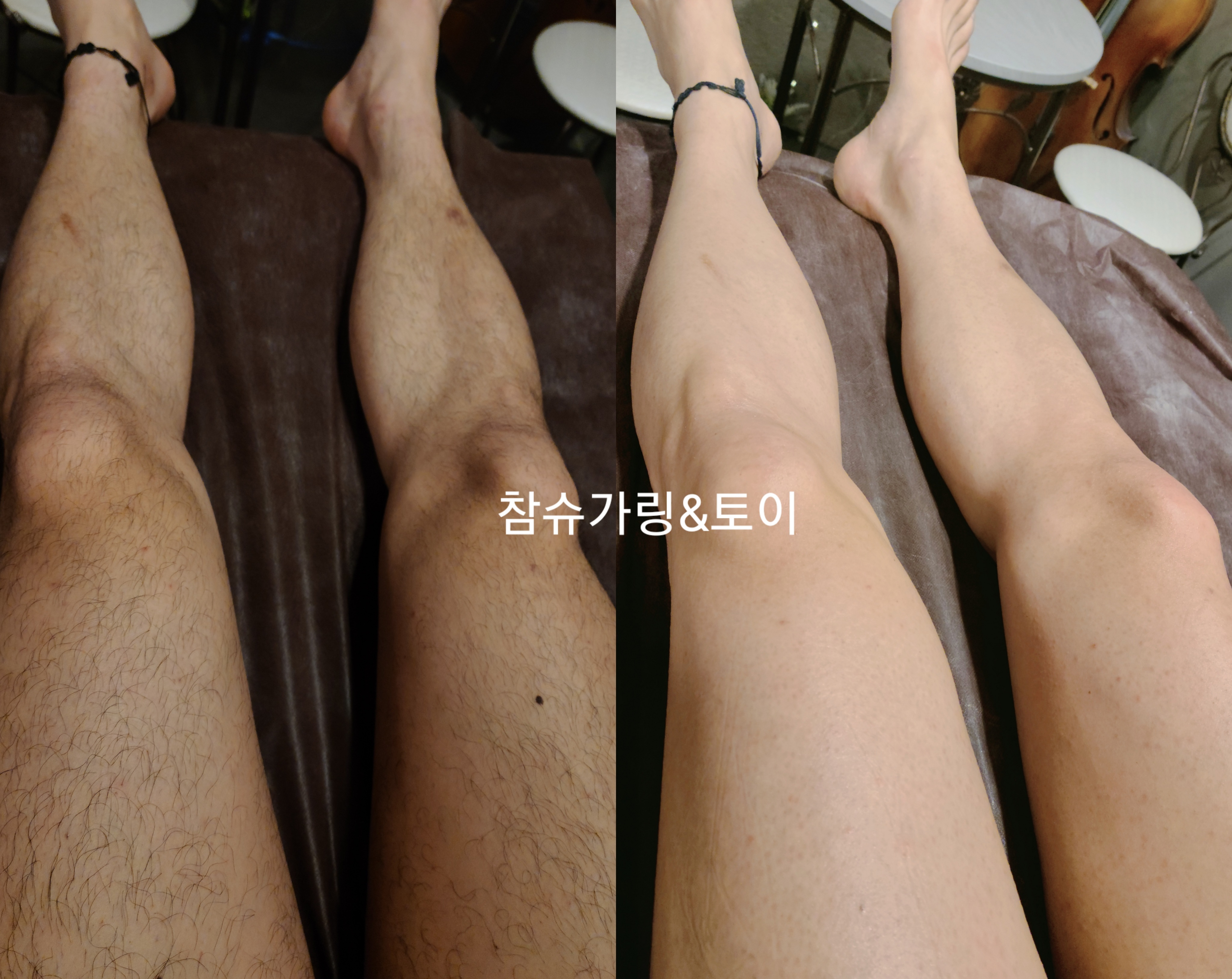 참슈가링왁싱