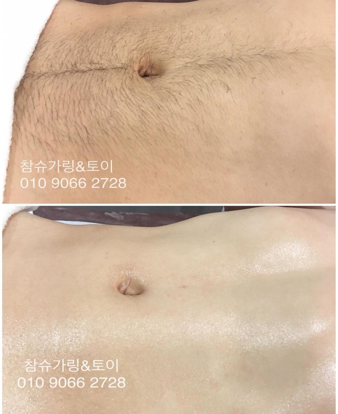 참슈가링왁싱