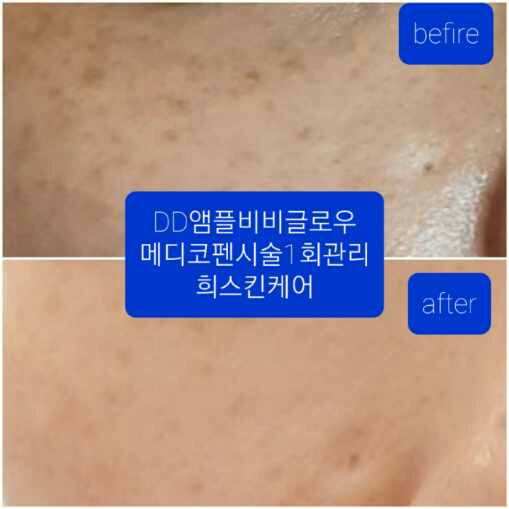 희 : 스킨케어