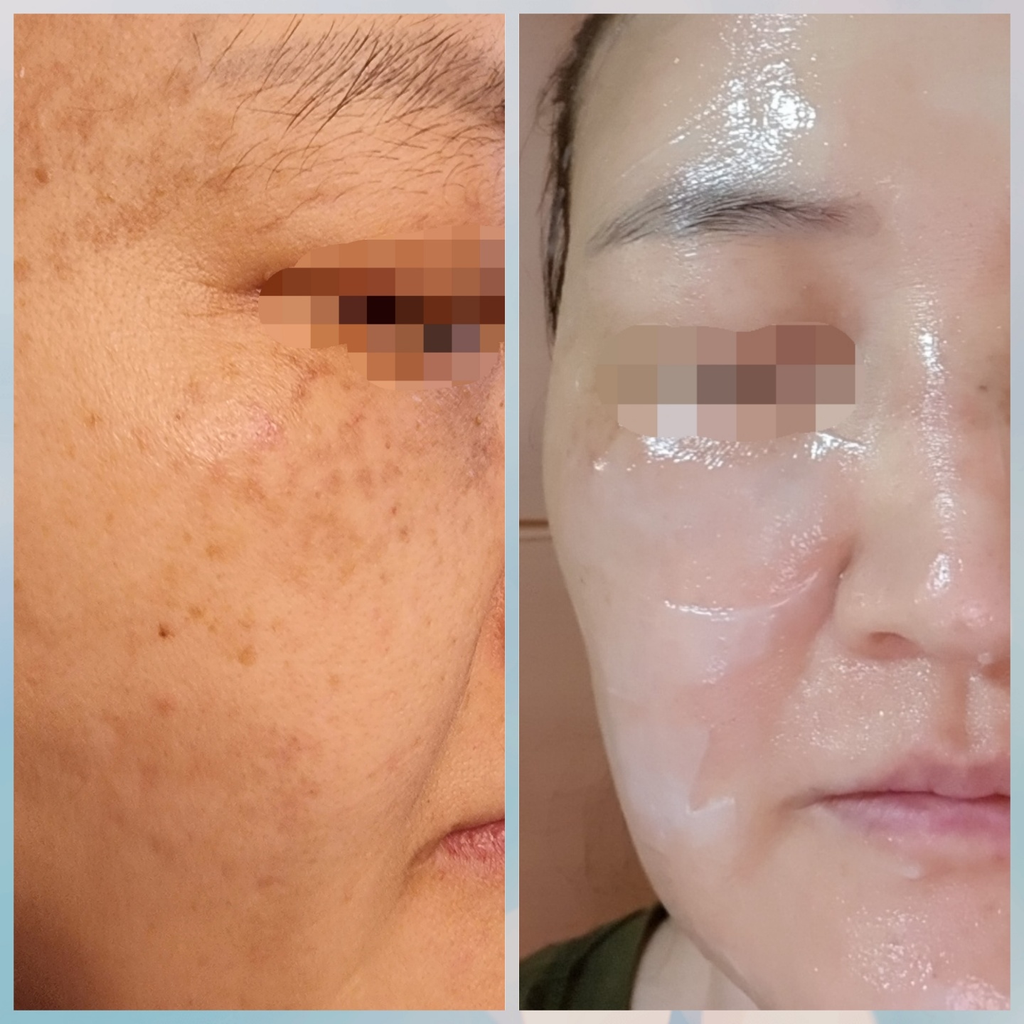 꿀스킨 대표 이미지