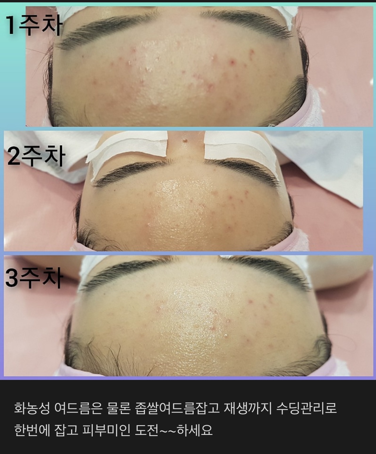 바비스킨앤바디 대표 이미지