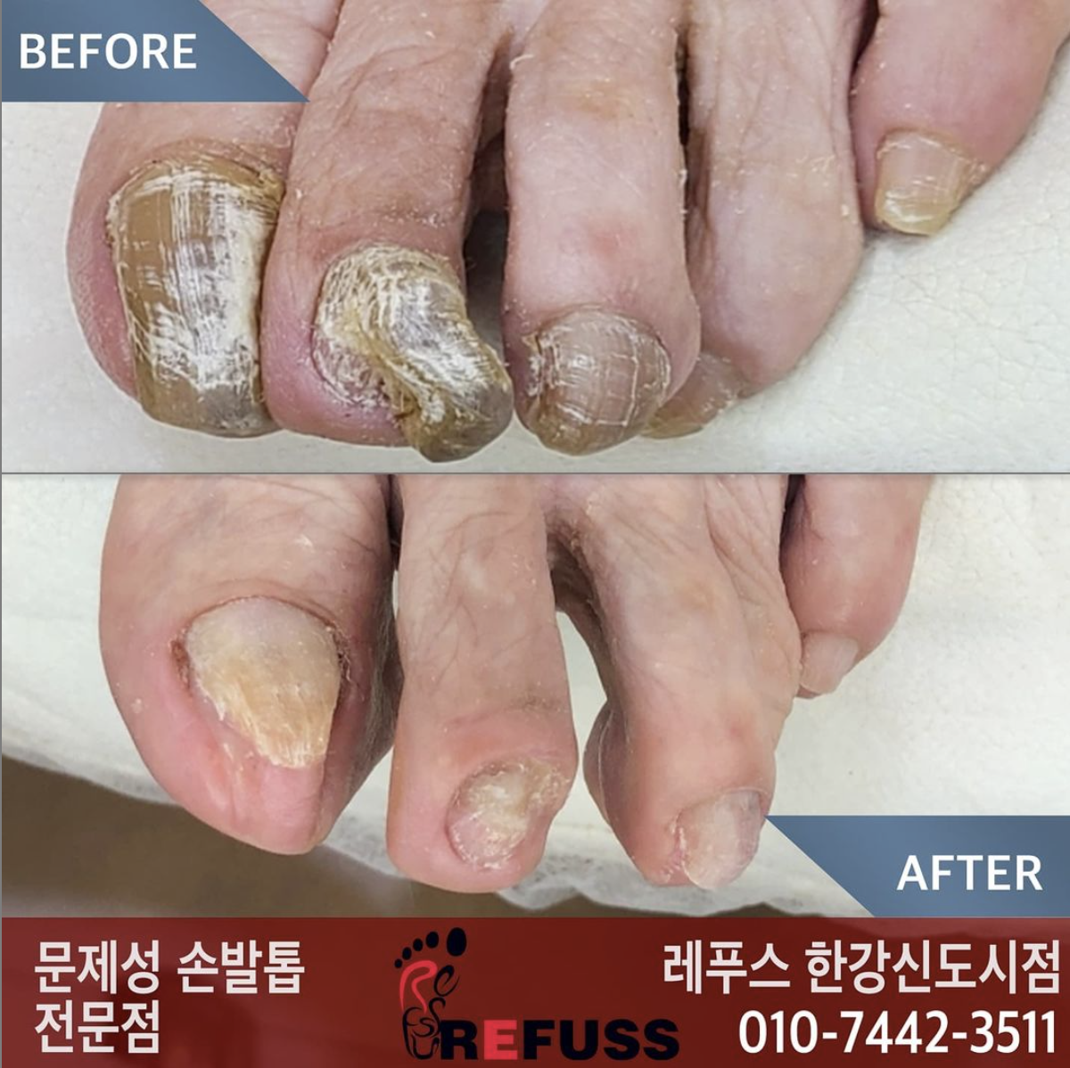 레푸스 김포 한강신도시점