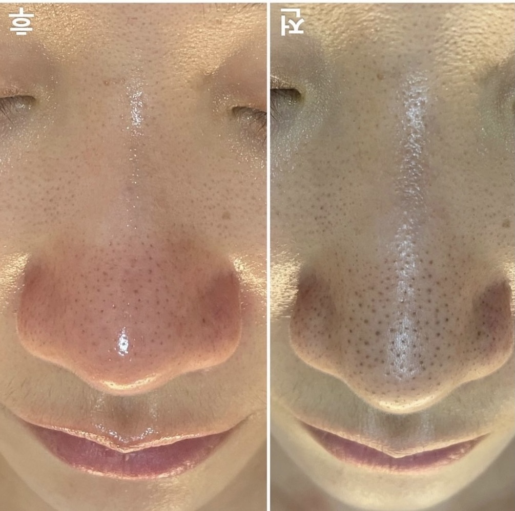 에스테무아 대표 이미지