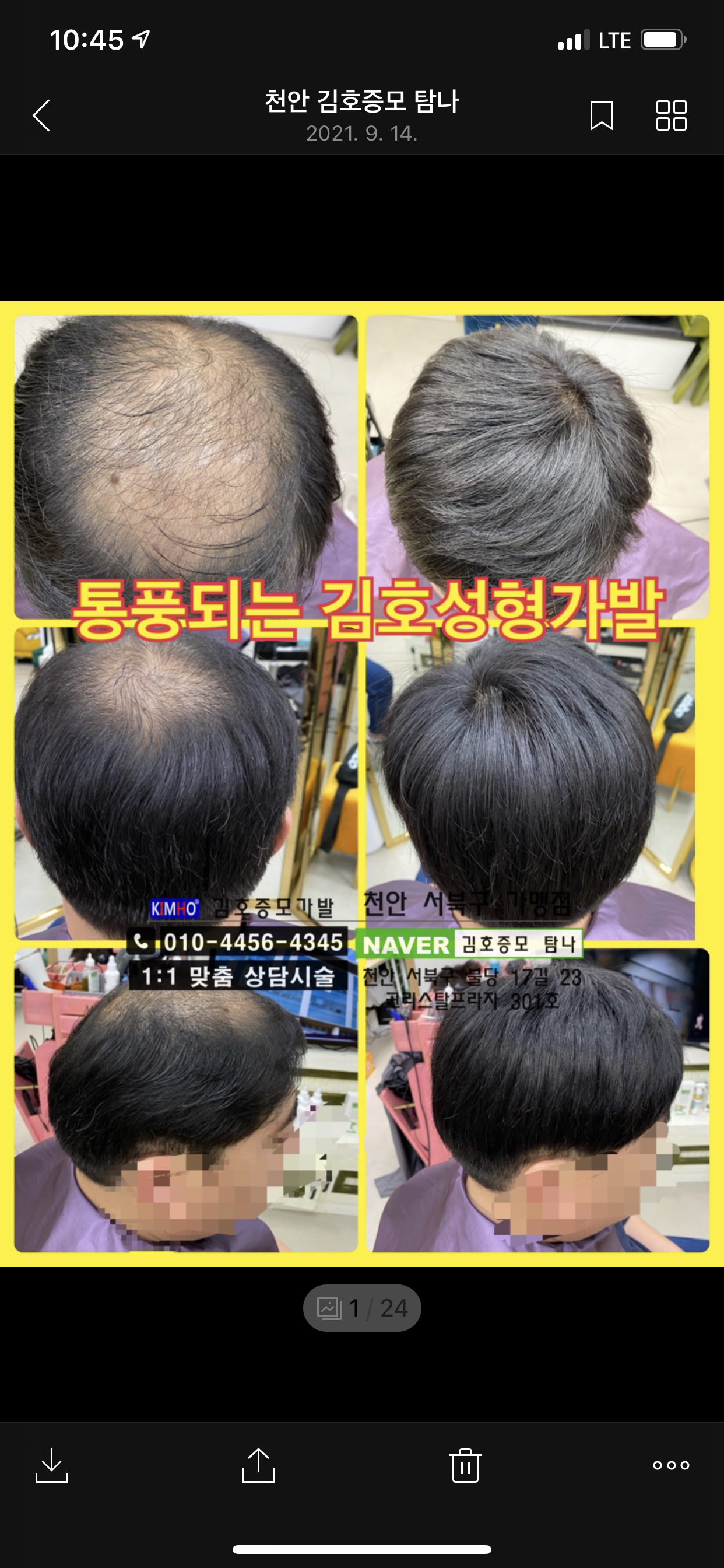 김호증모가발 탐나