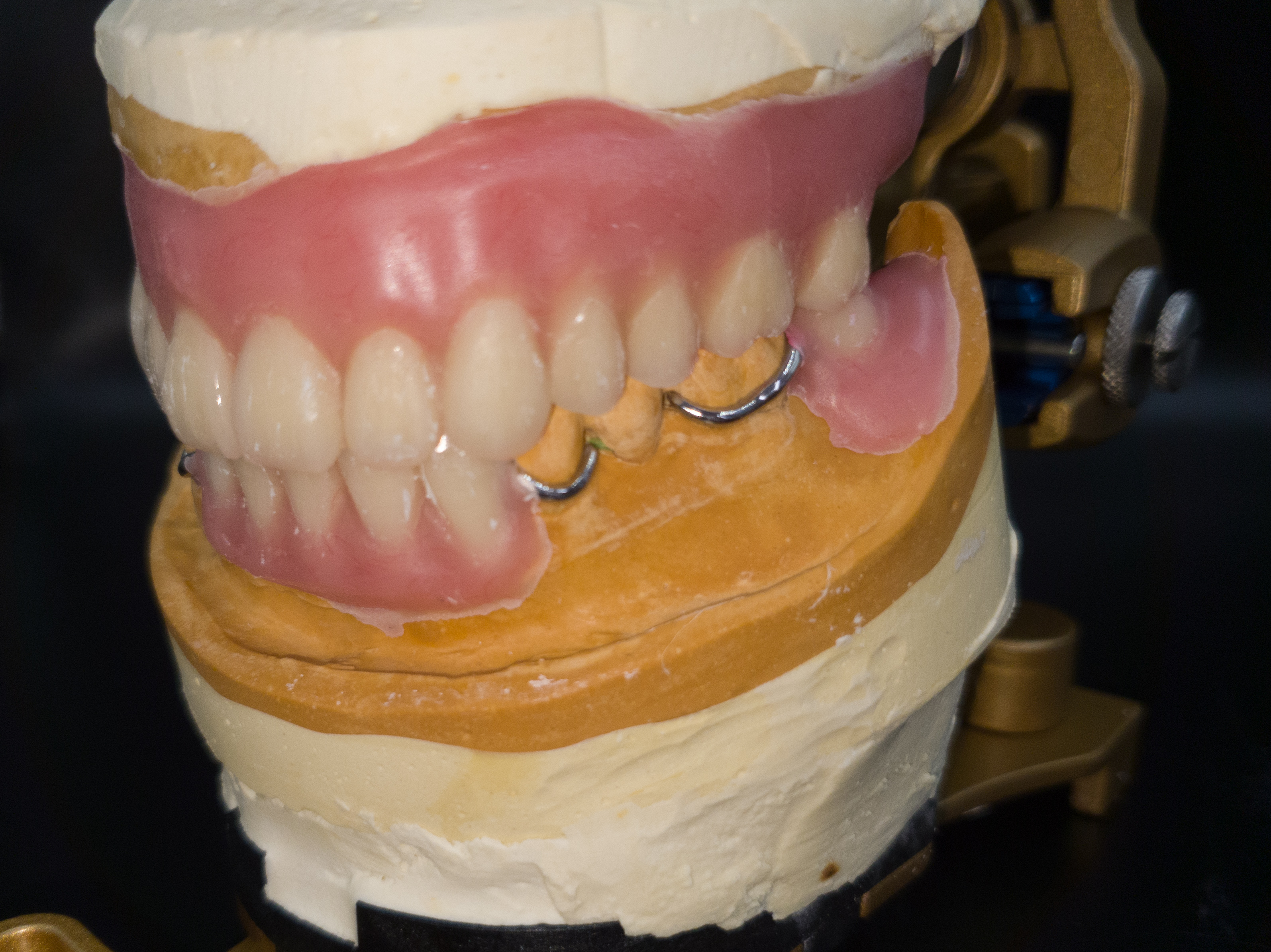 유에이블치과기공소 대표 이미지