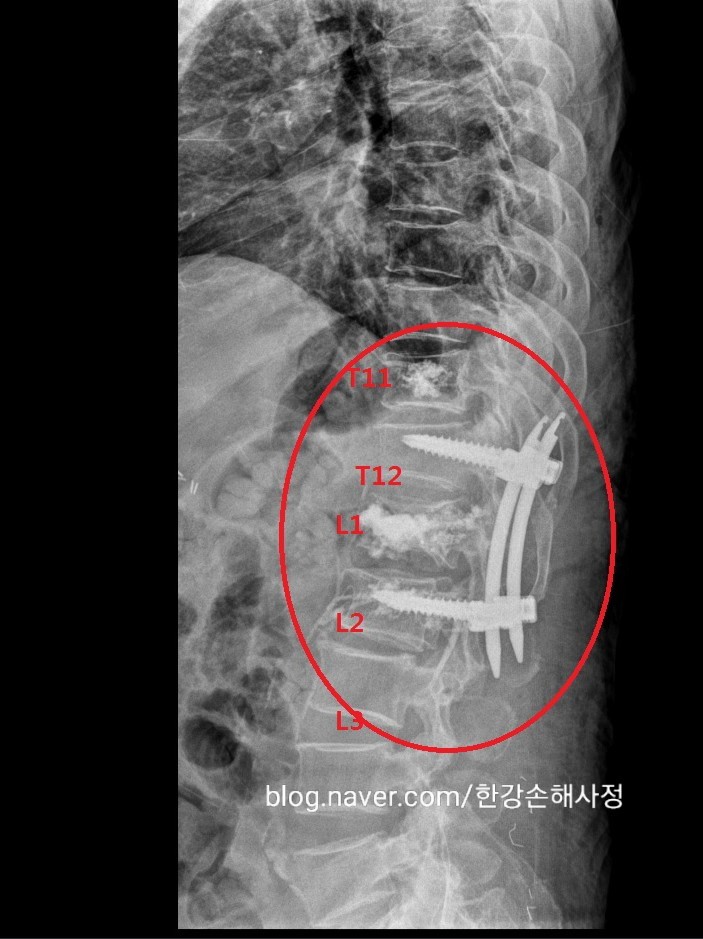 교통사고무료상담센터 율로손해사정 대표 이미지