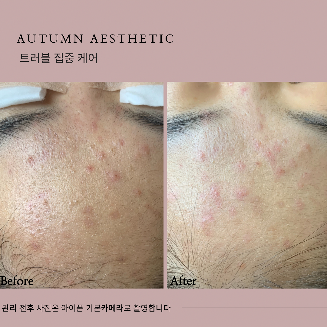 어텀에스테틱 안양범계점 대표 이미지