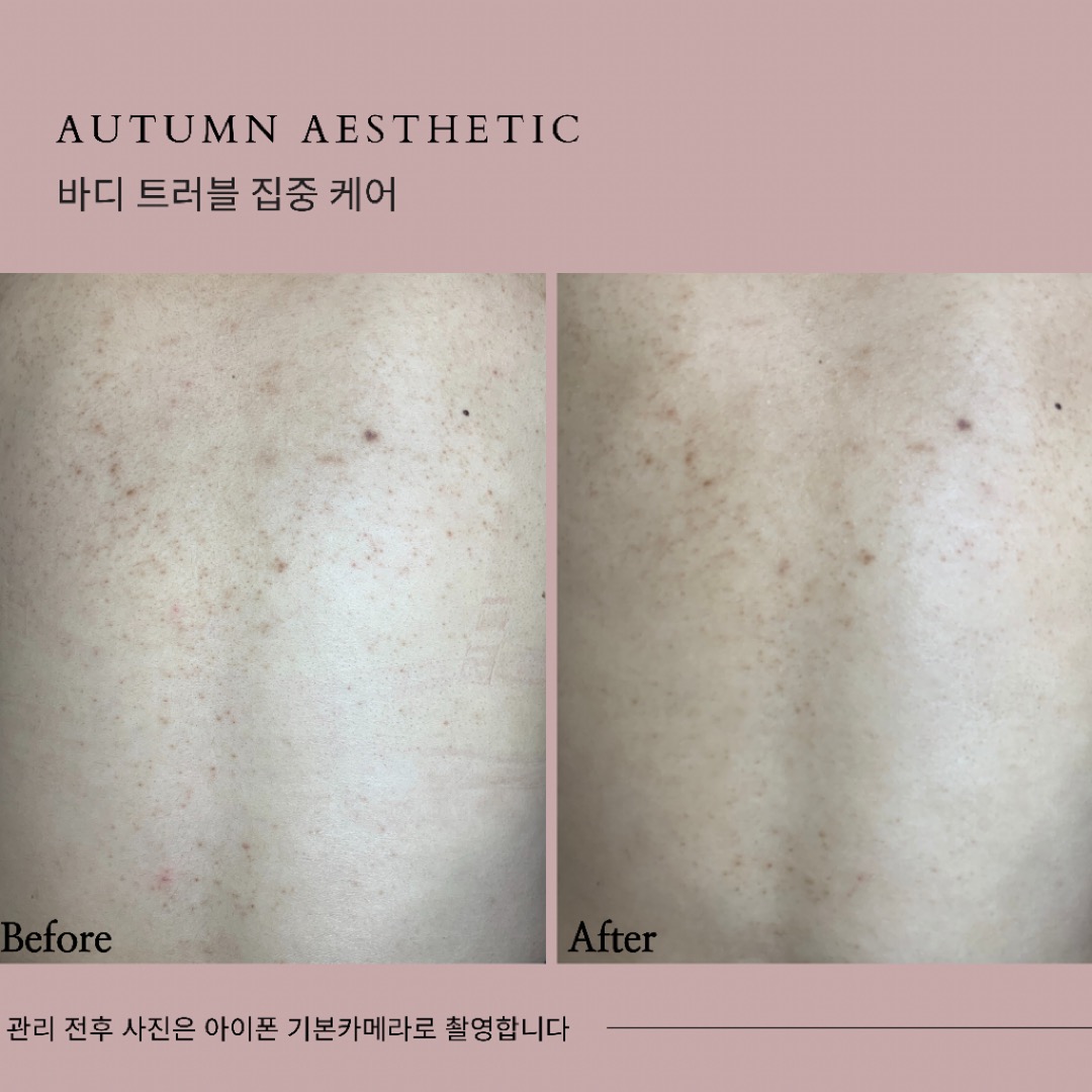 어텀에스테틱 안양범계점 대표 이미지