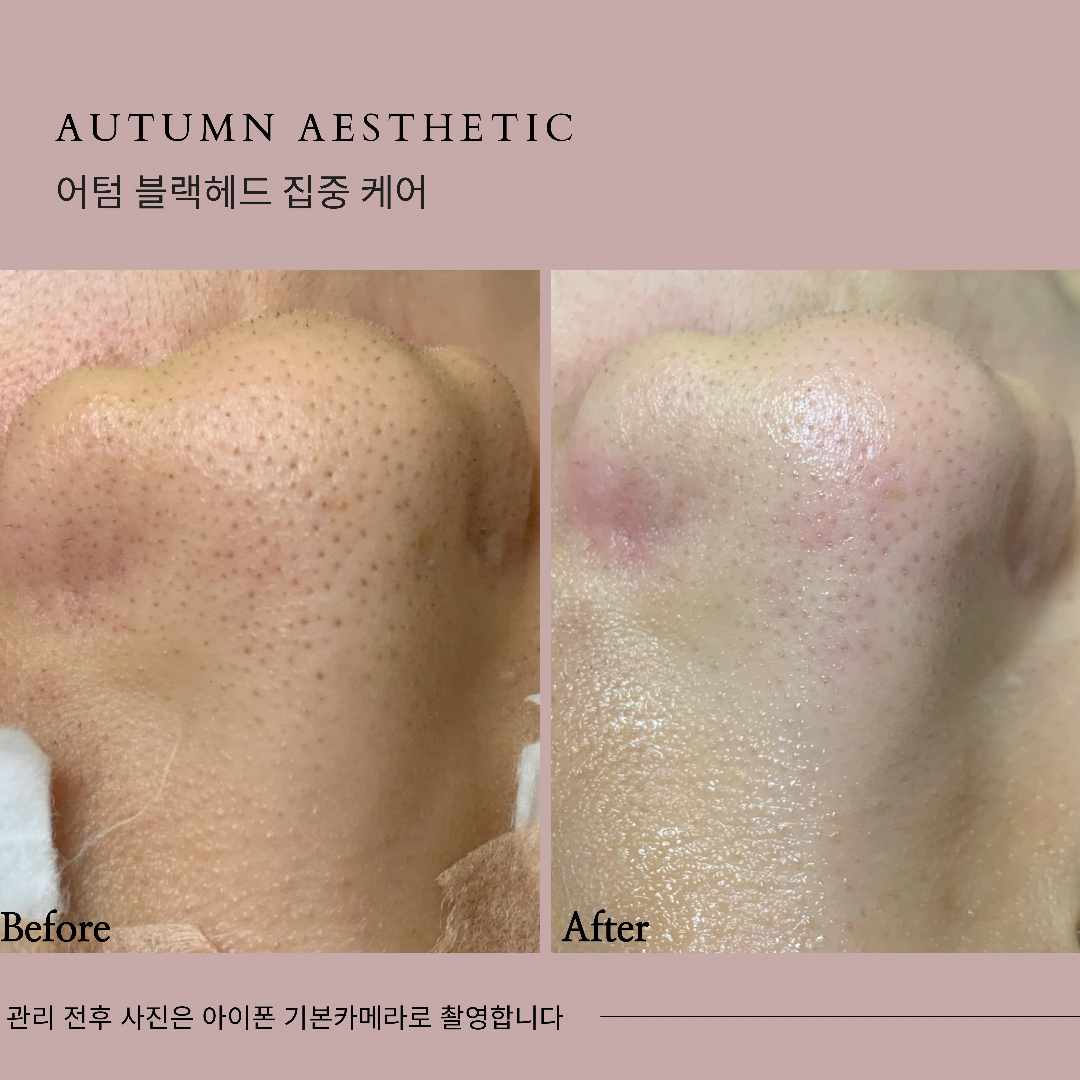 어텀에스테틱 안양범계점 대표 이미지