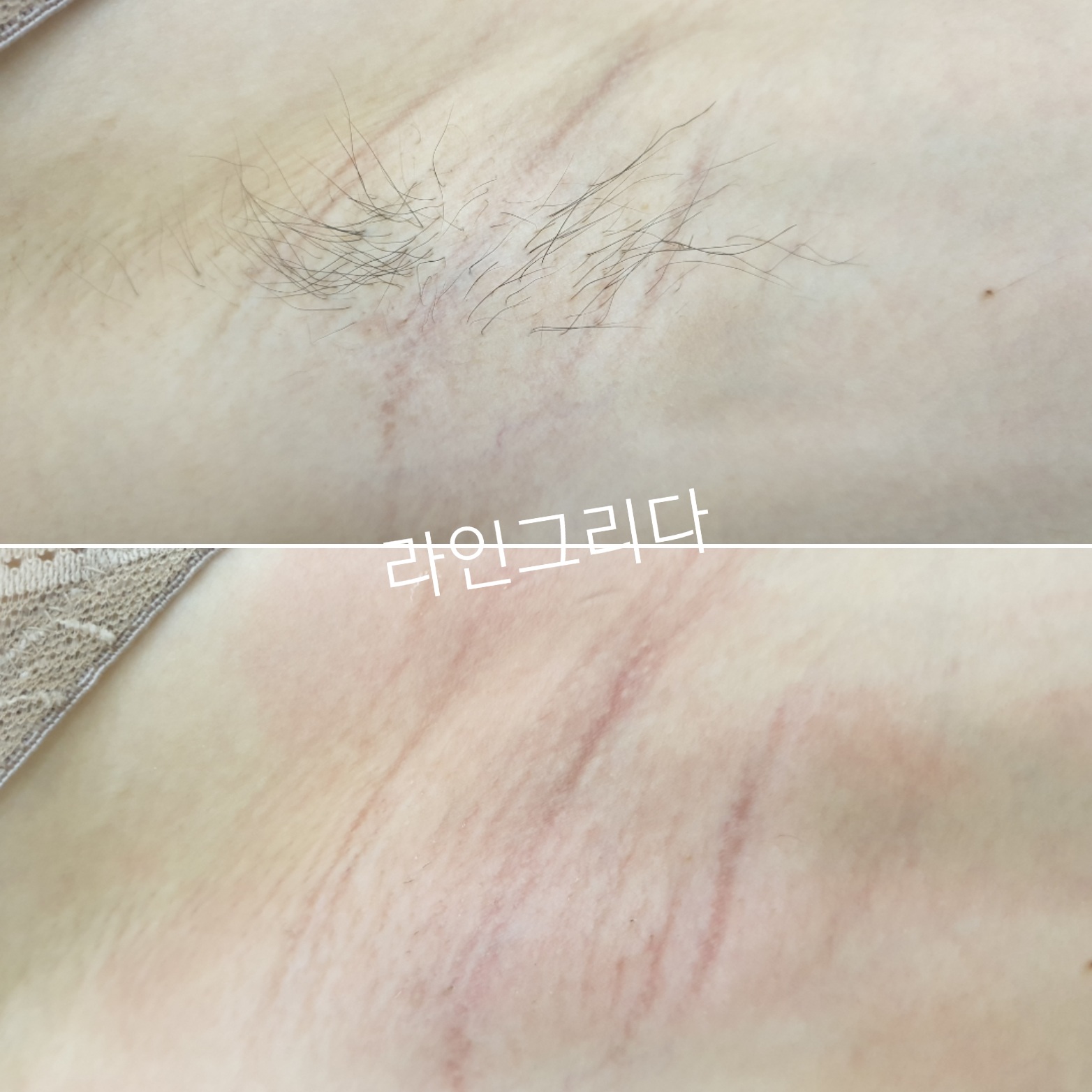라인그리다