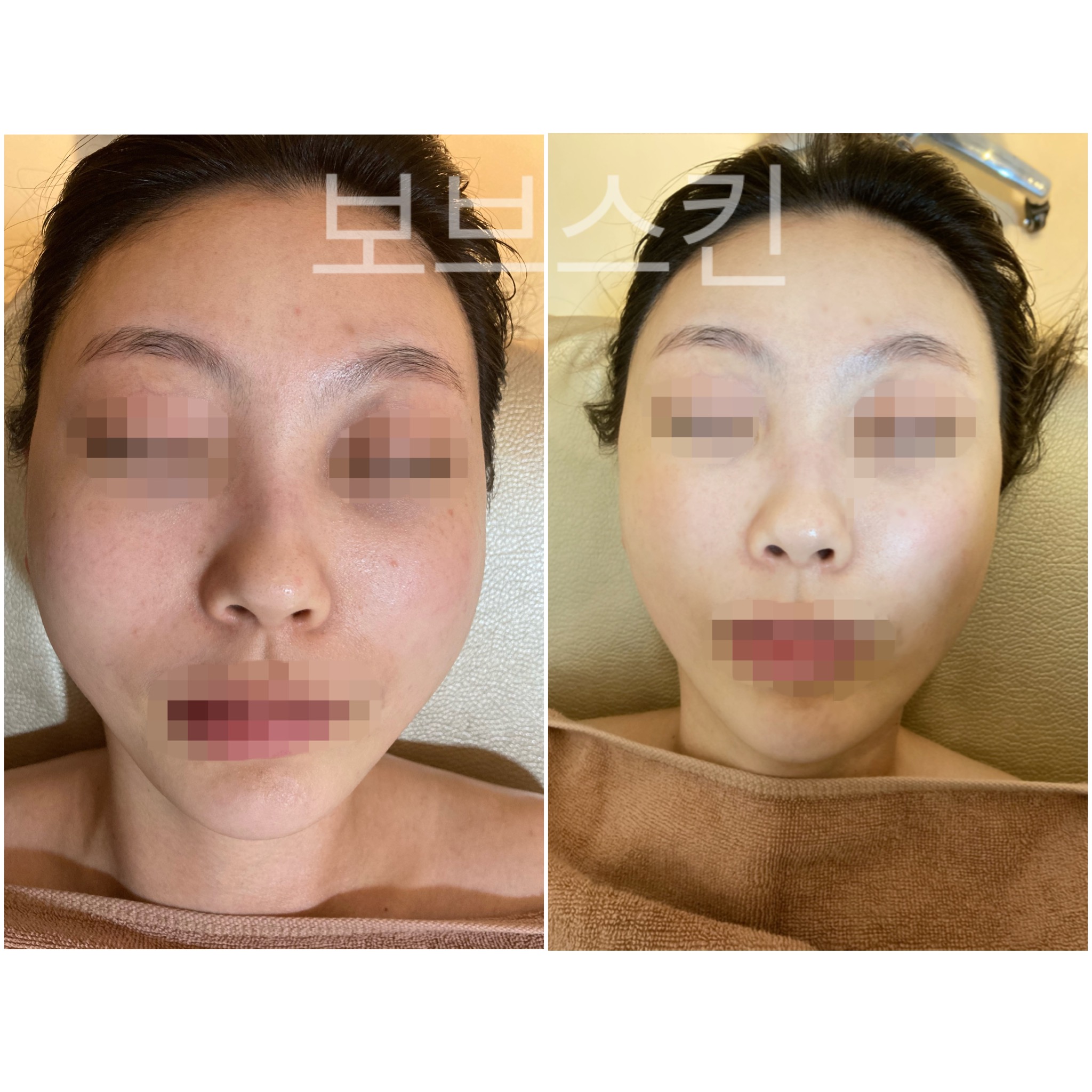 보브스킨