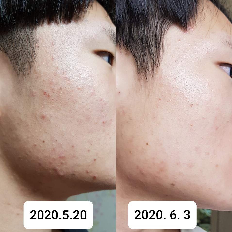 미쁘다 셀비아