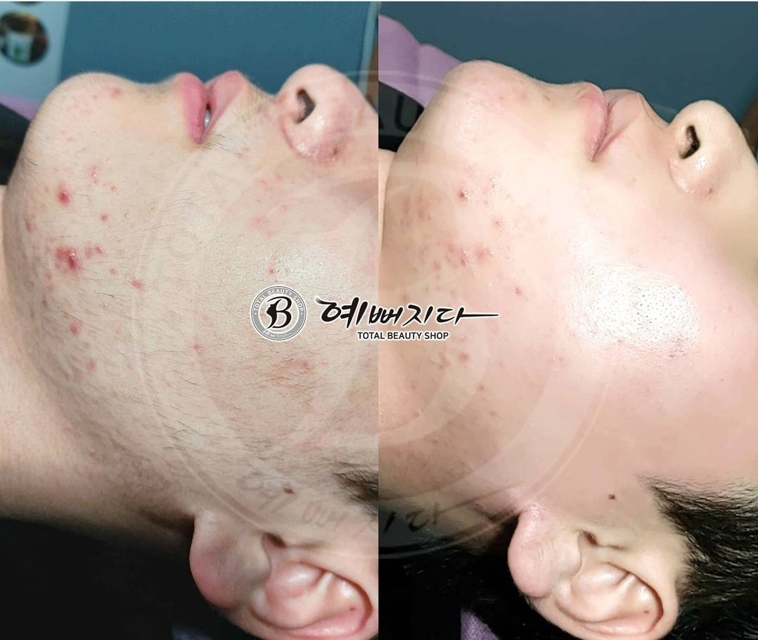 예뻐지다 photo 5