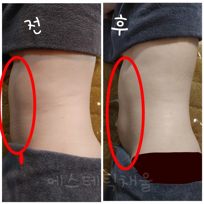 에스테틱 채울