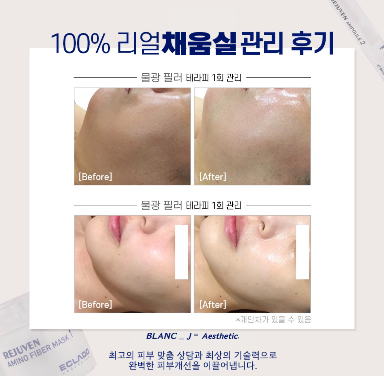 에스테틱 차온