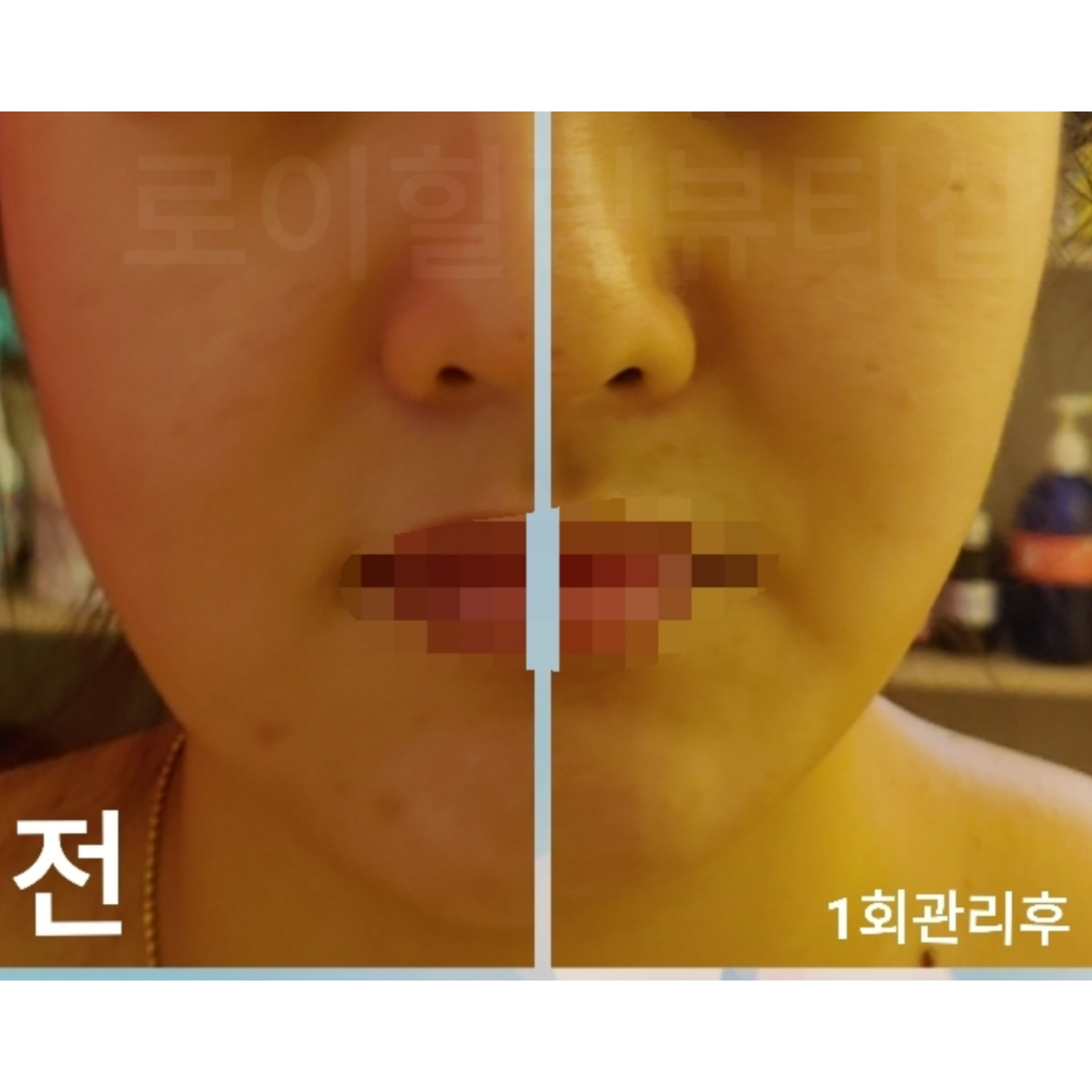 이아소에스떼