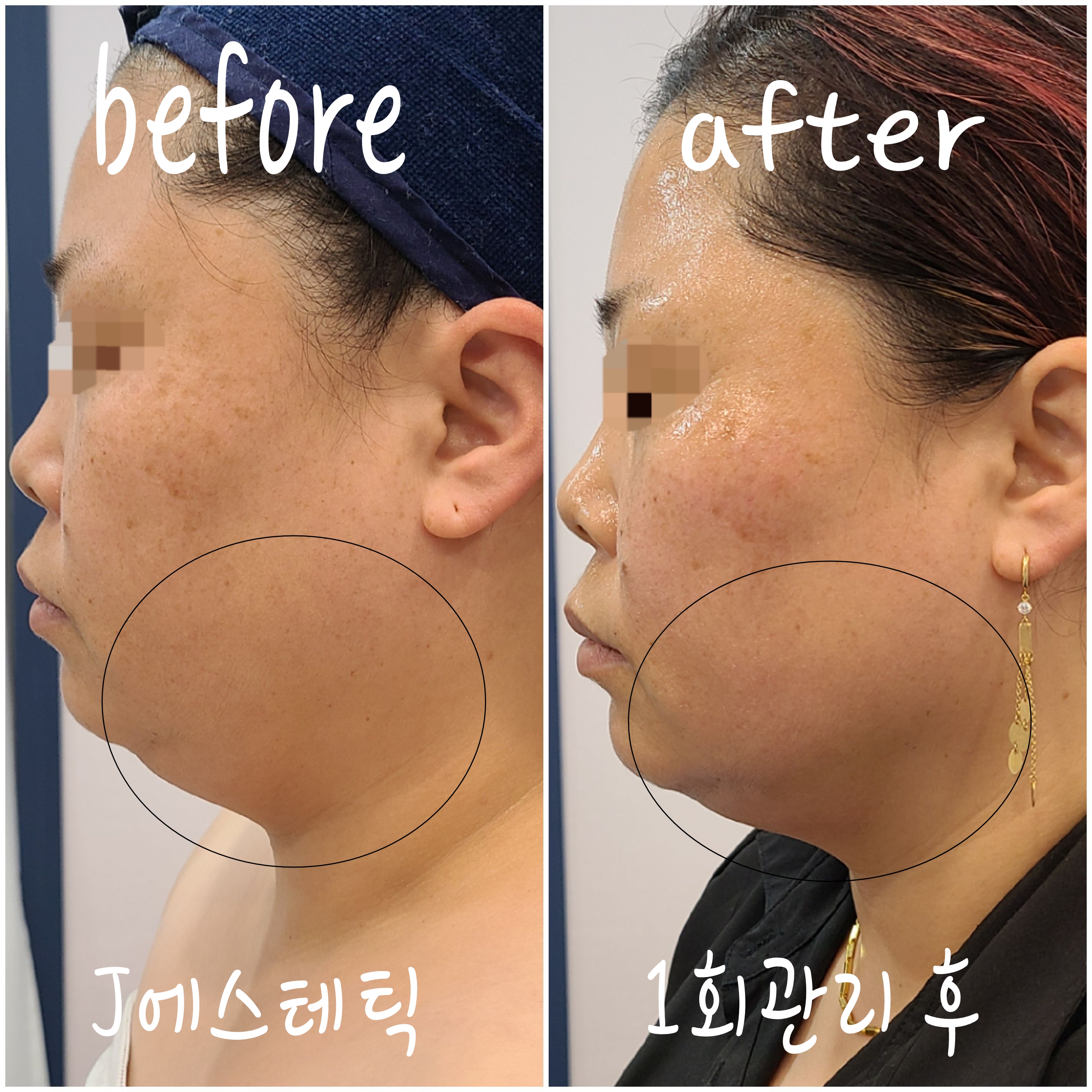 J에스테틱 대표 이미지