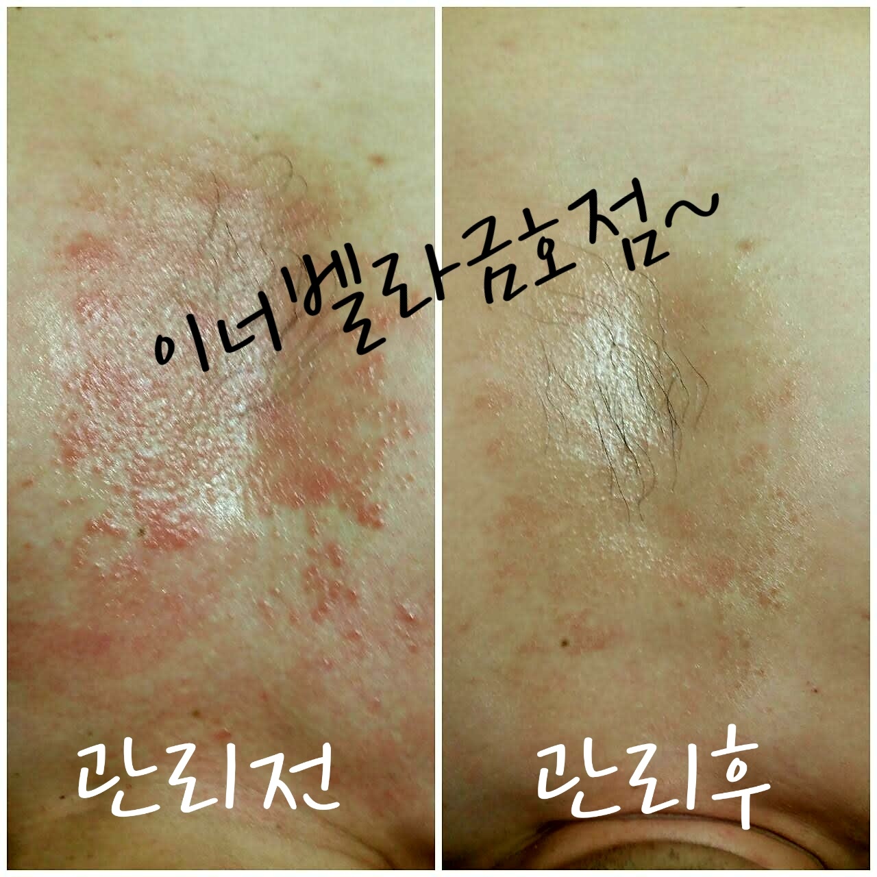 이너벨라 광주금호점