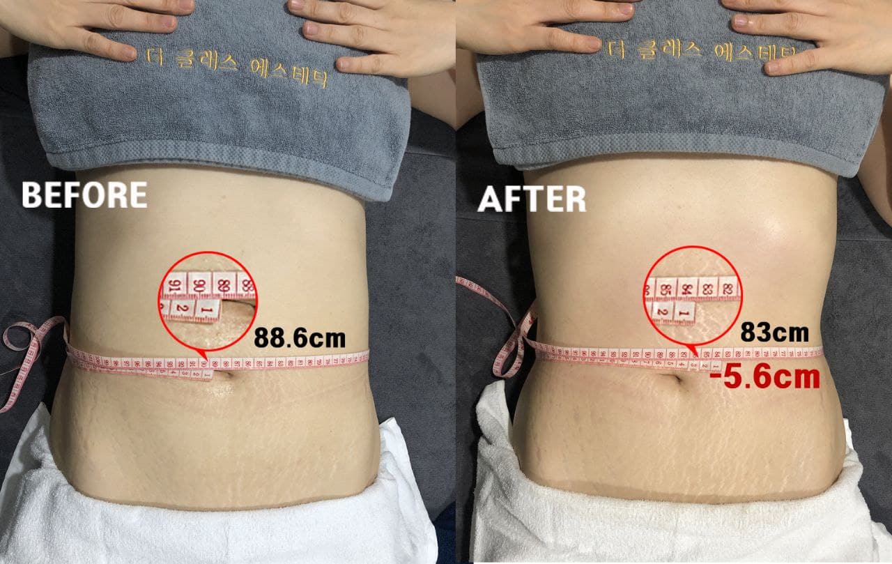 더 클래스 에스테틱