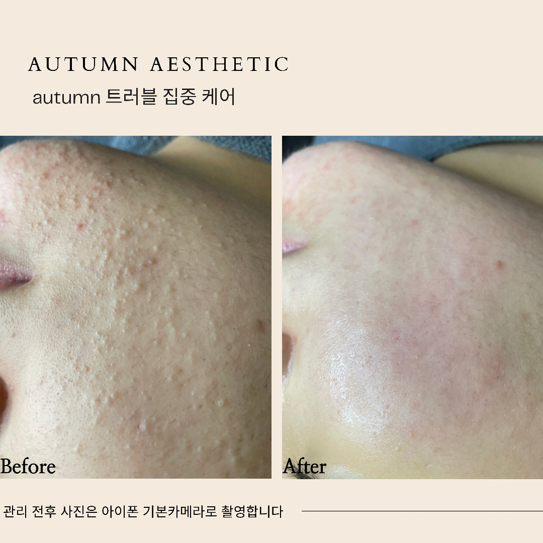 어텀에스테틱 안양범계점 대표 이미지
