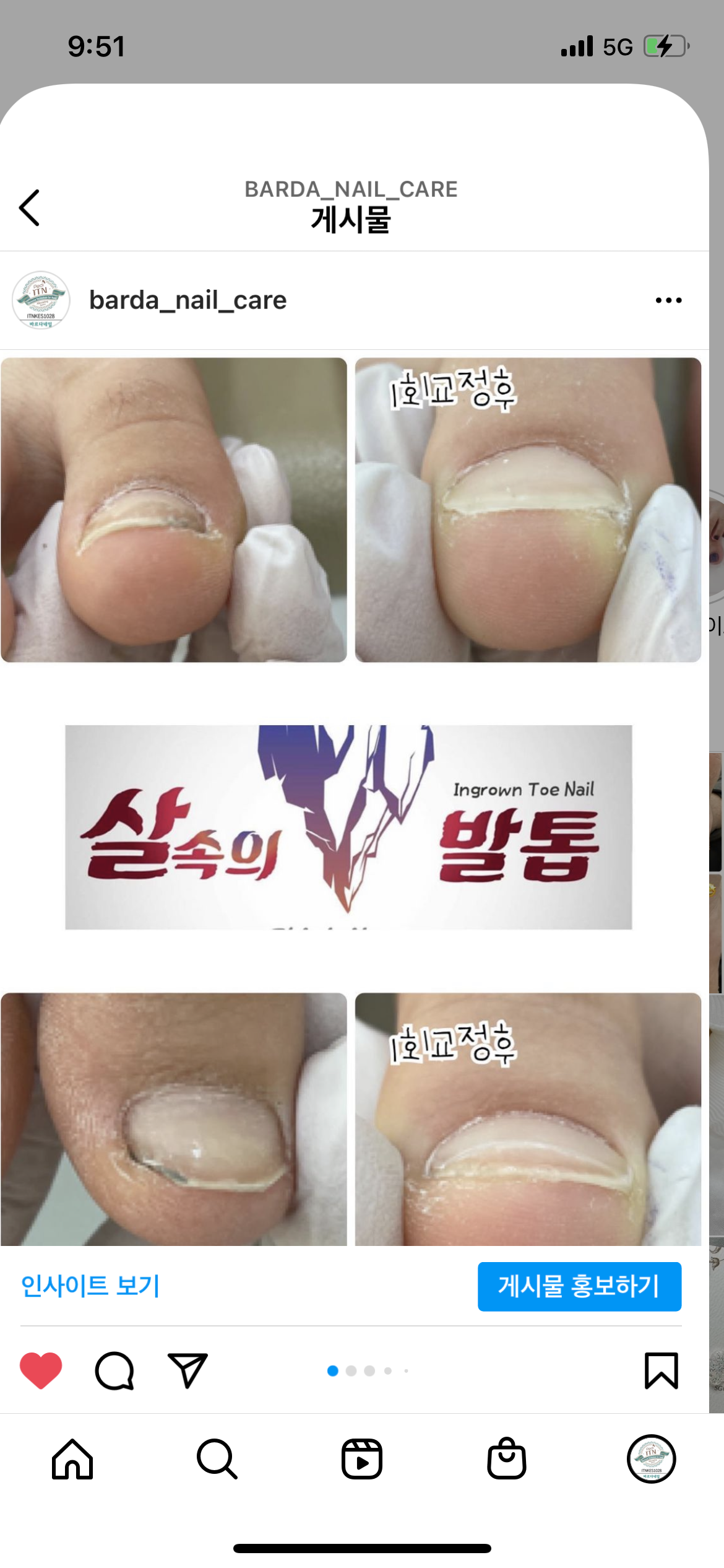 바르다네일