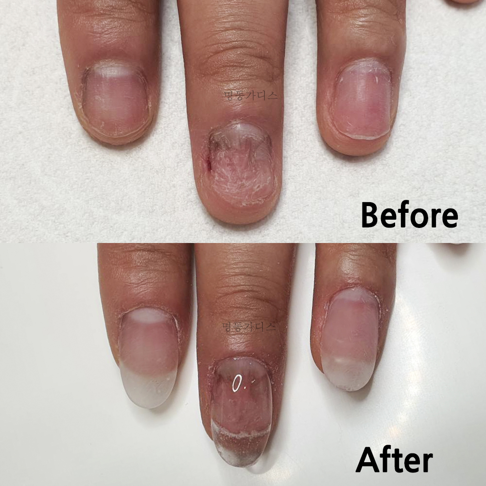 가디스네일 대표 이미지