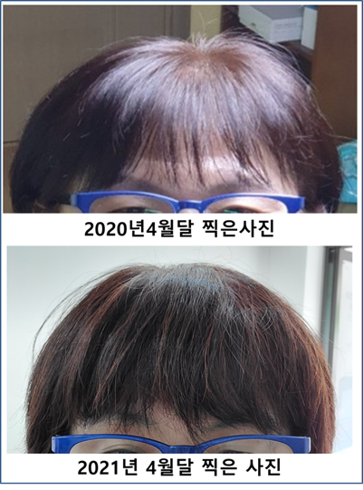 하라힐즈헤나. 탈모관리.두피케어