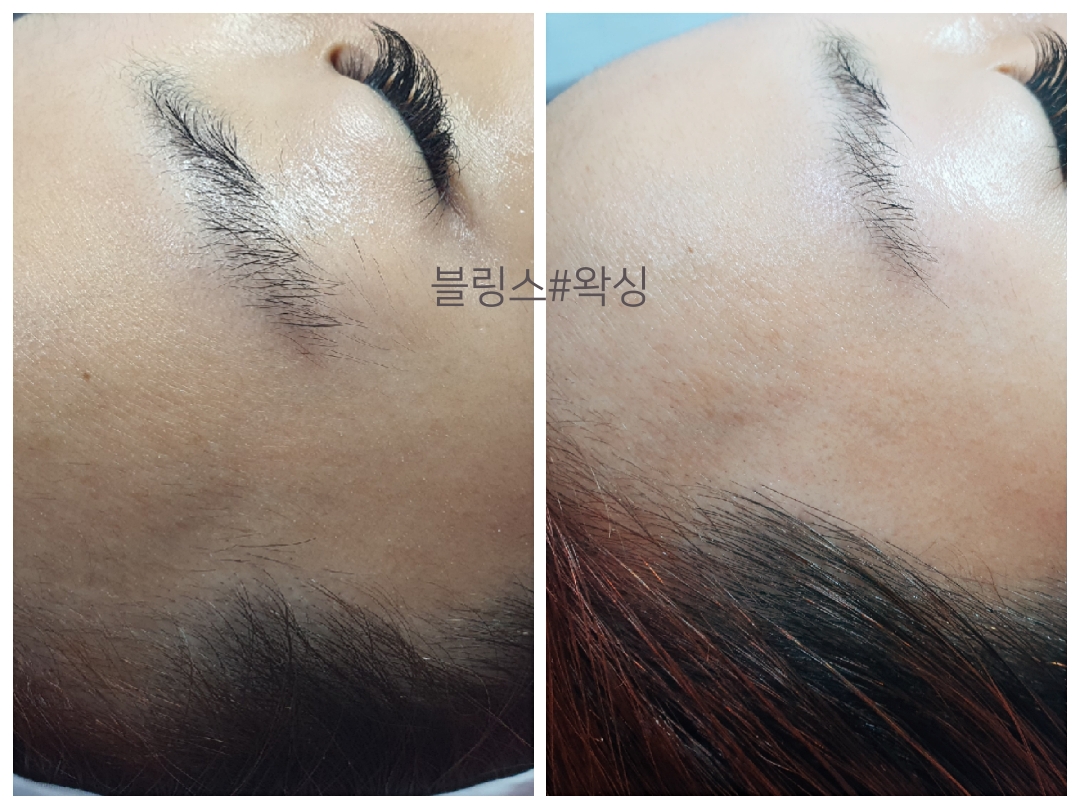 블링스왁싱 노원점