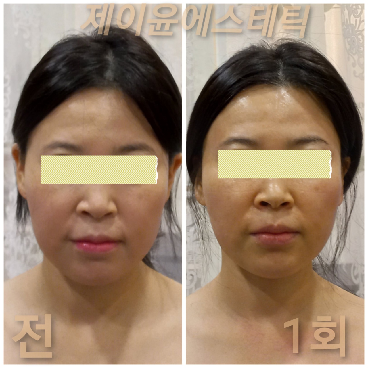 제이윤 에스테틱
