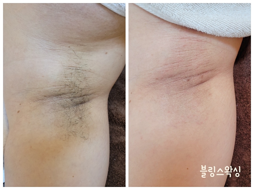 블링스왁싱 노원점