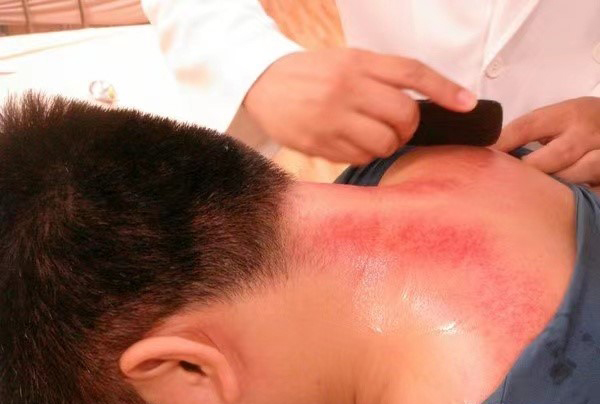 황궁중국정통마사지 대표 이미지