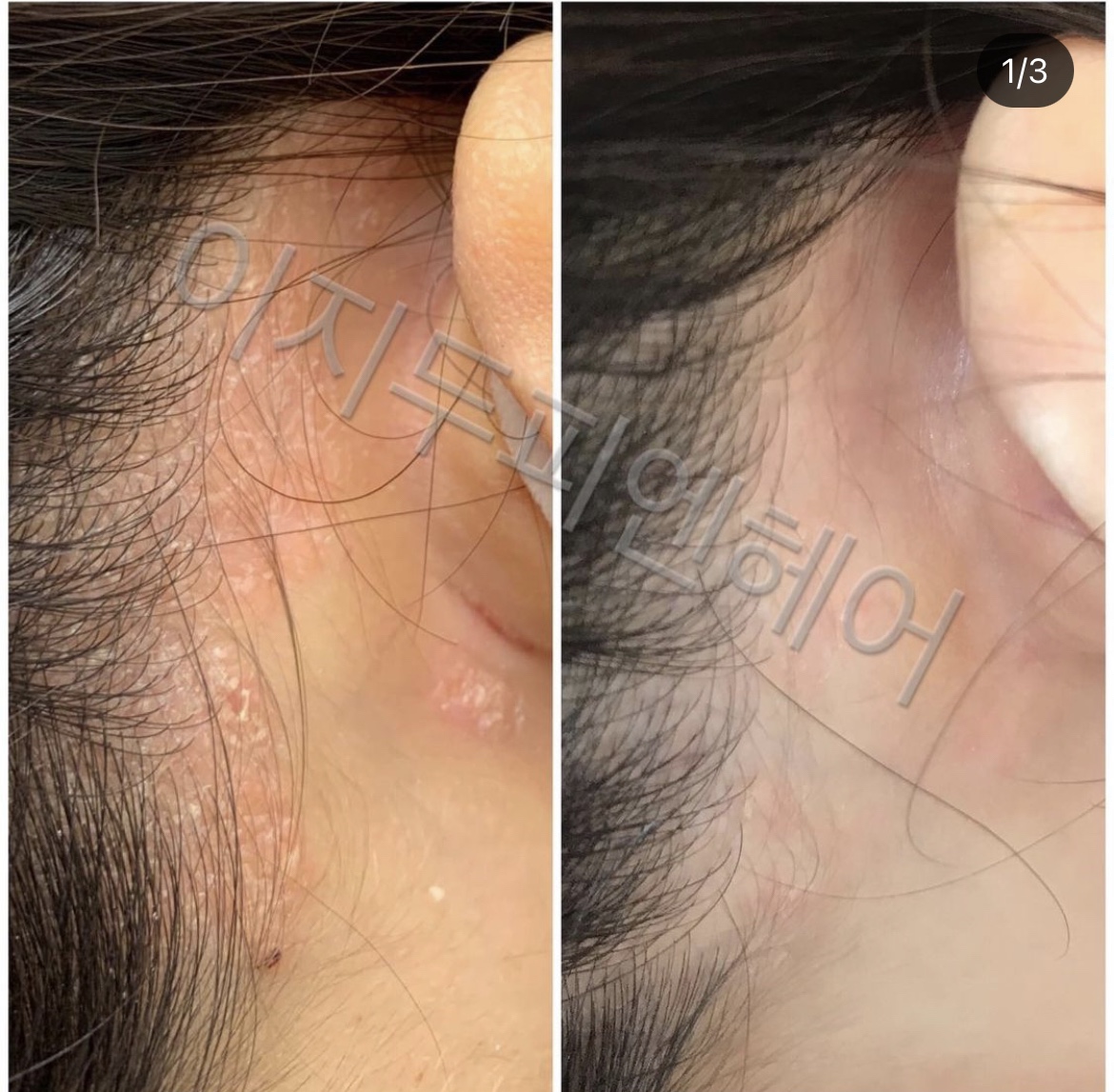 리원스탈모 두피클리닉센터 대표 이미지