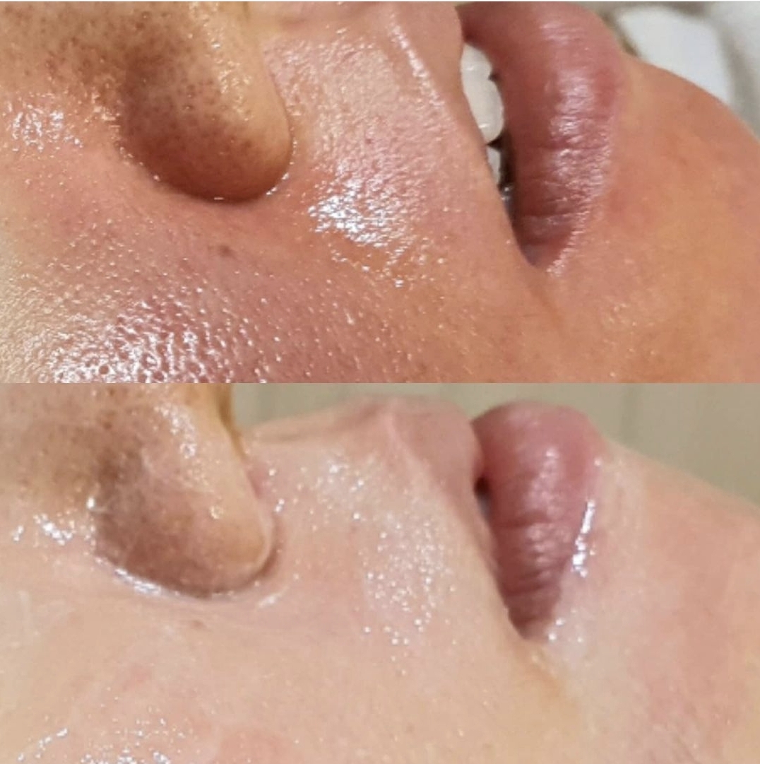 스와니예 대표 이미지