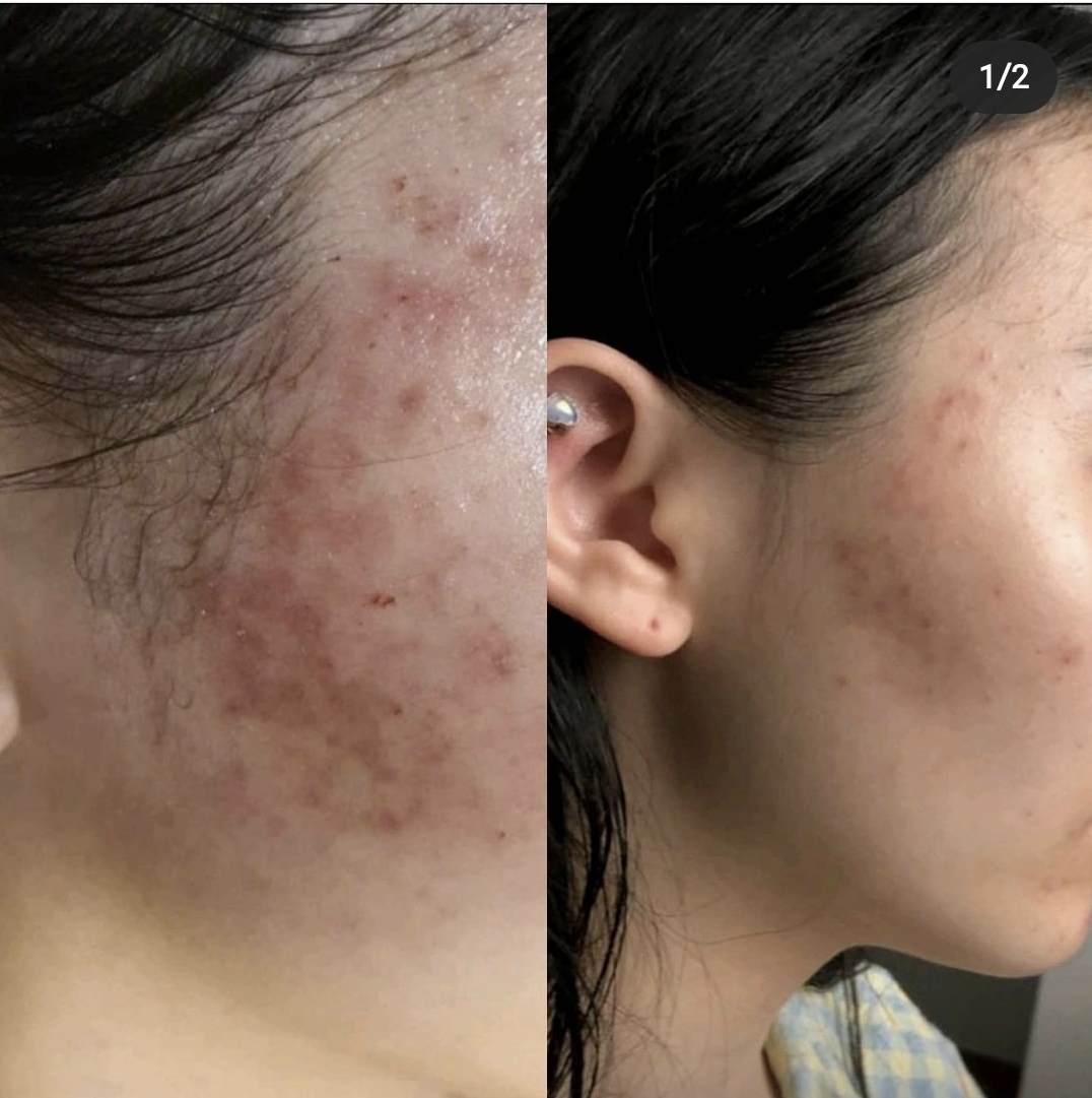 스와니예 대표 이미지