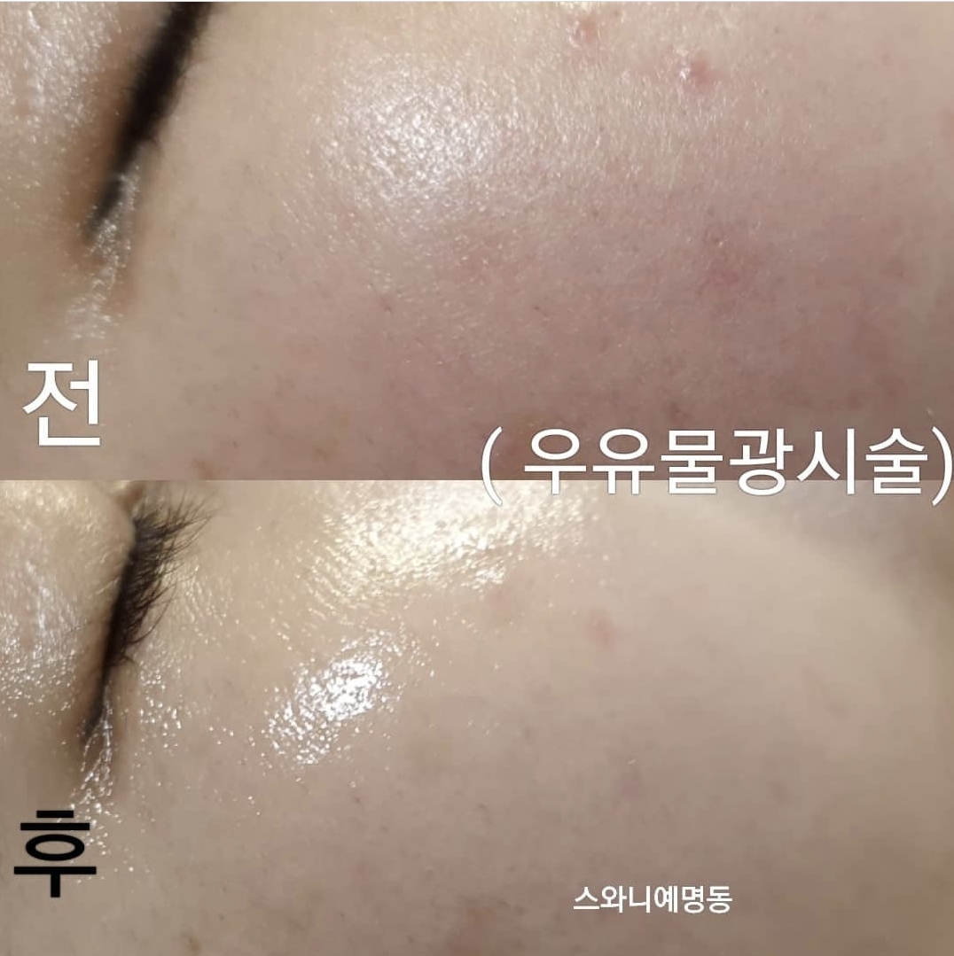 스와니예 대표 이미지