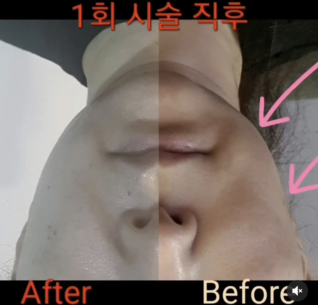 스와니예 대표 이미지