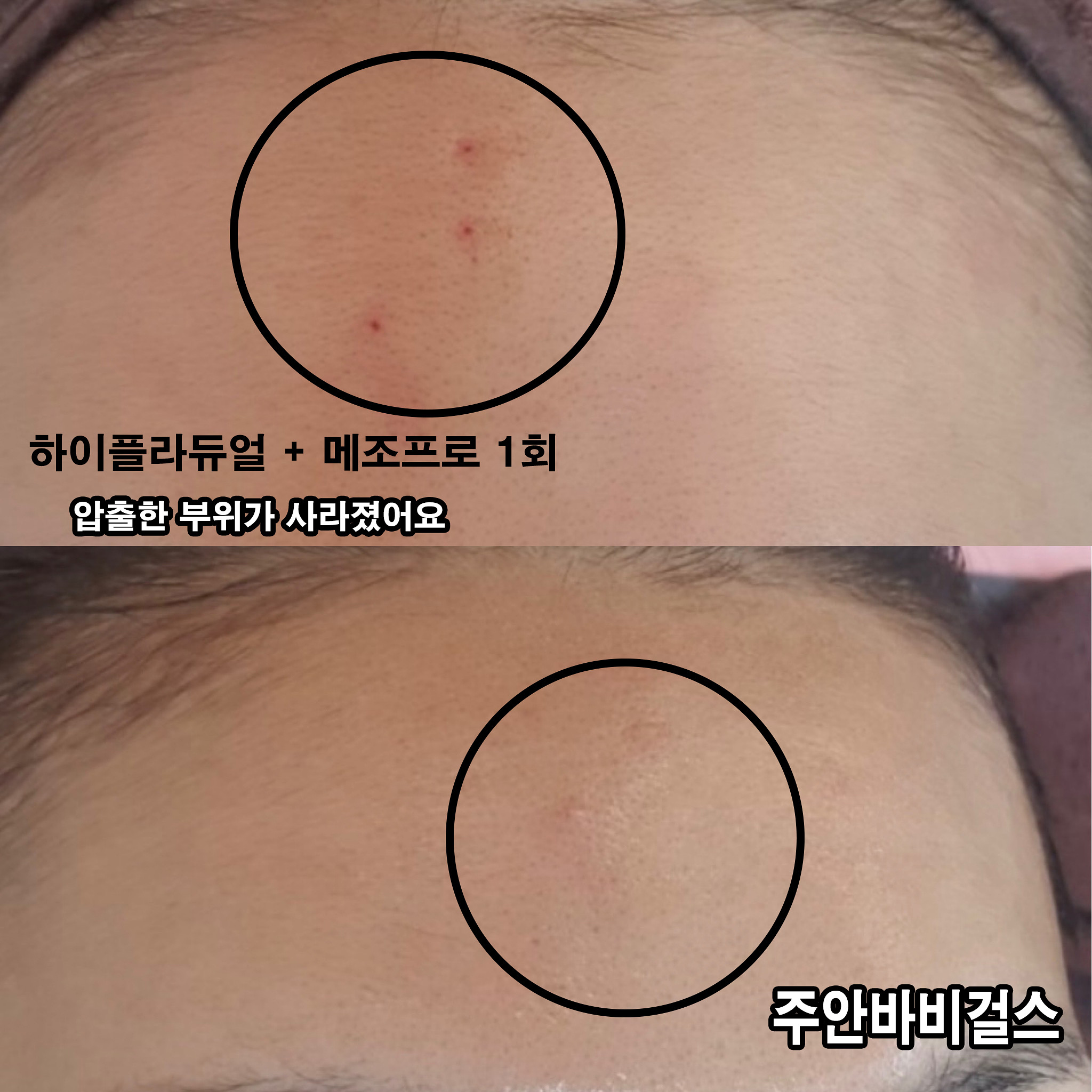 뷰티리셋 대표 이미지