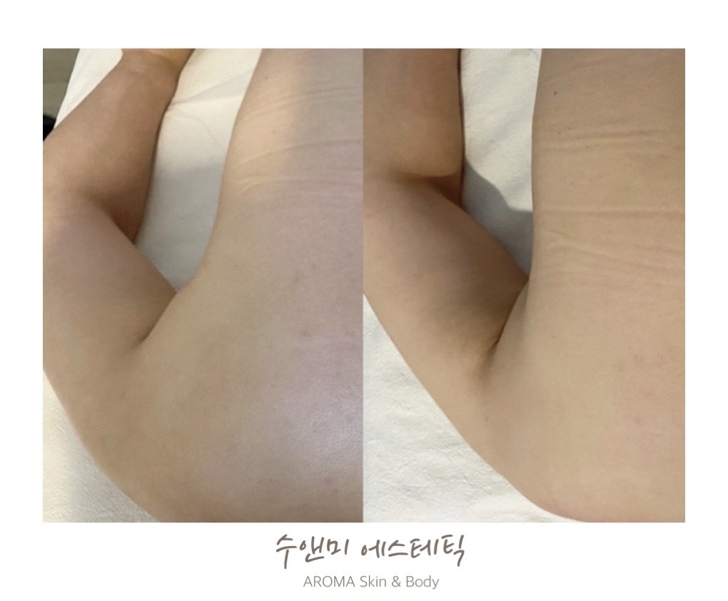 수앤미 에스테틱 대표 이미지