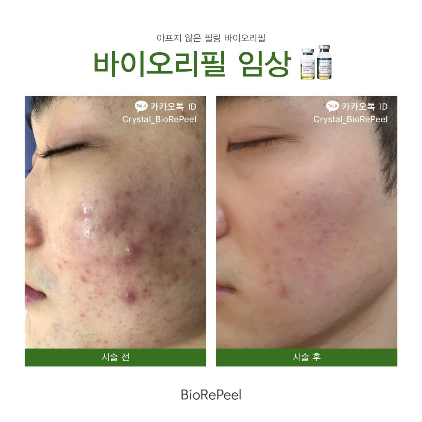 아미띠에 photo 10