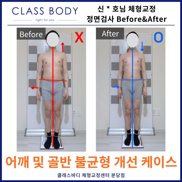 클래스바디 체형교정센터 분당서현점