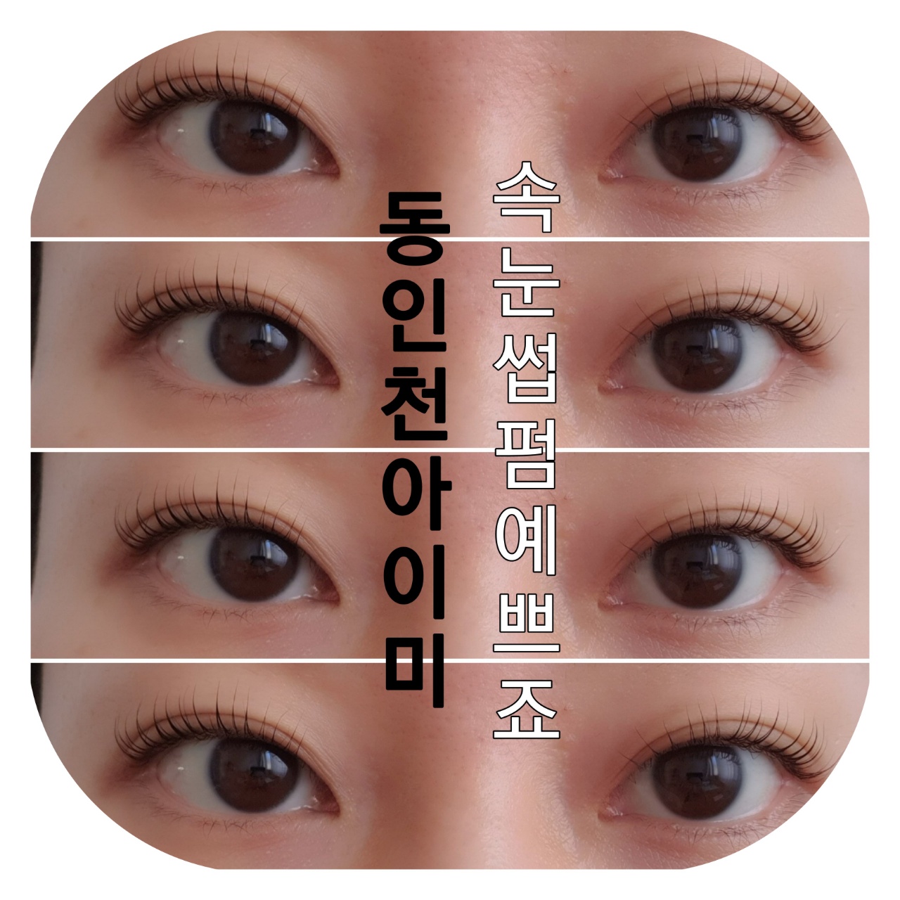 아이미 대표 이미지