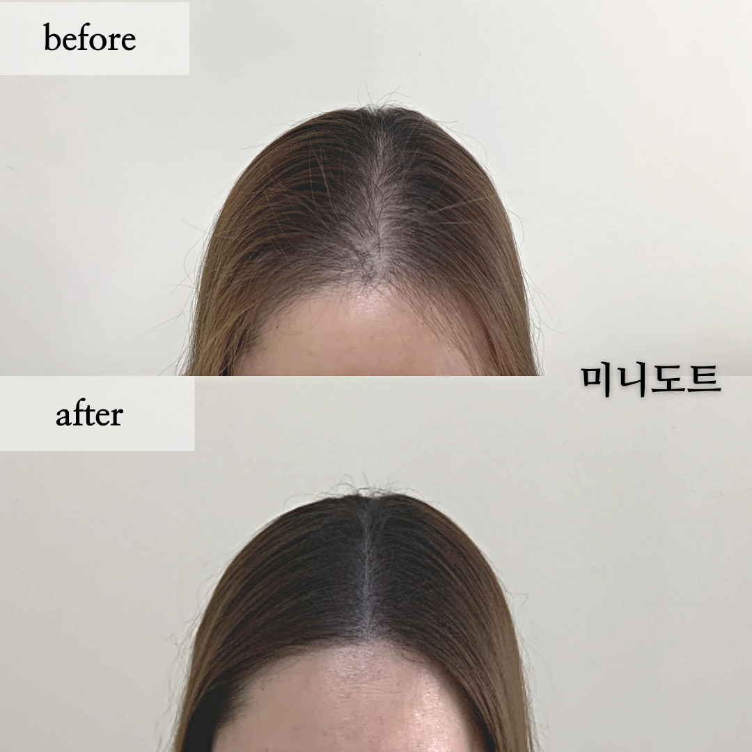 미니도트 대표 이미지