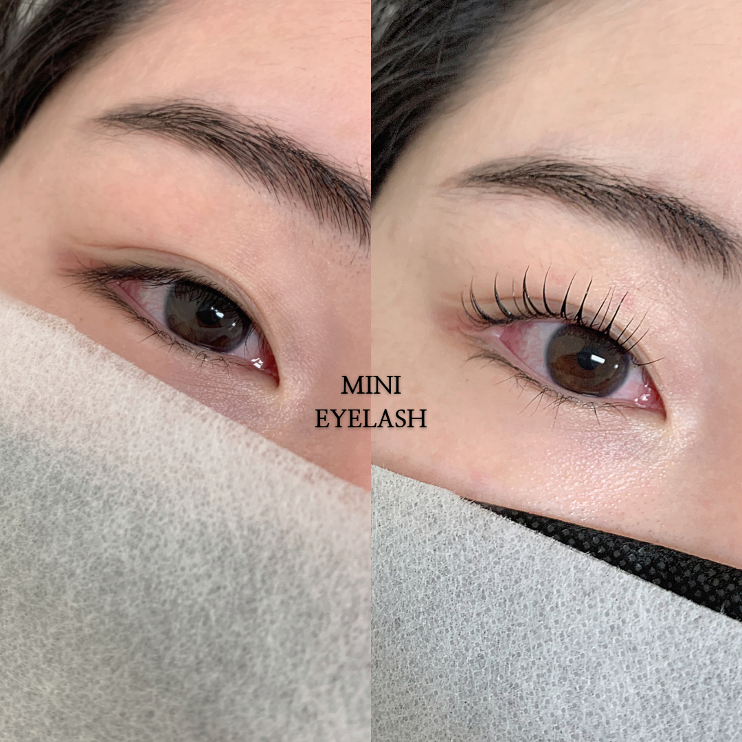 미니도트 대표 이미지