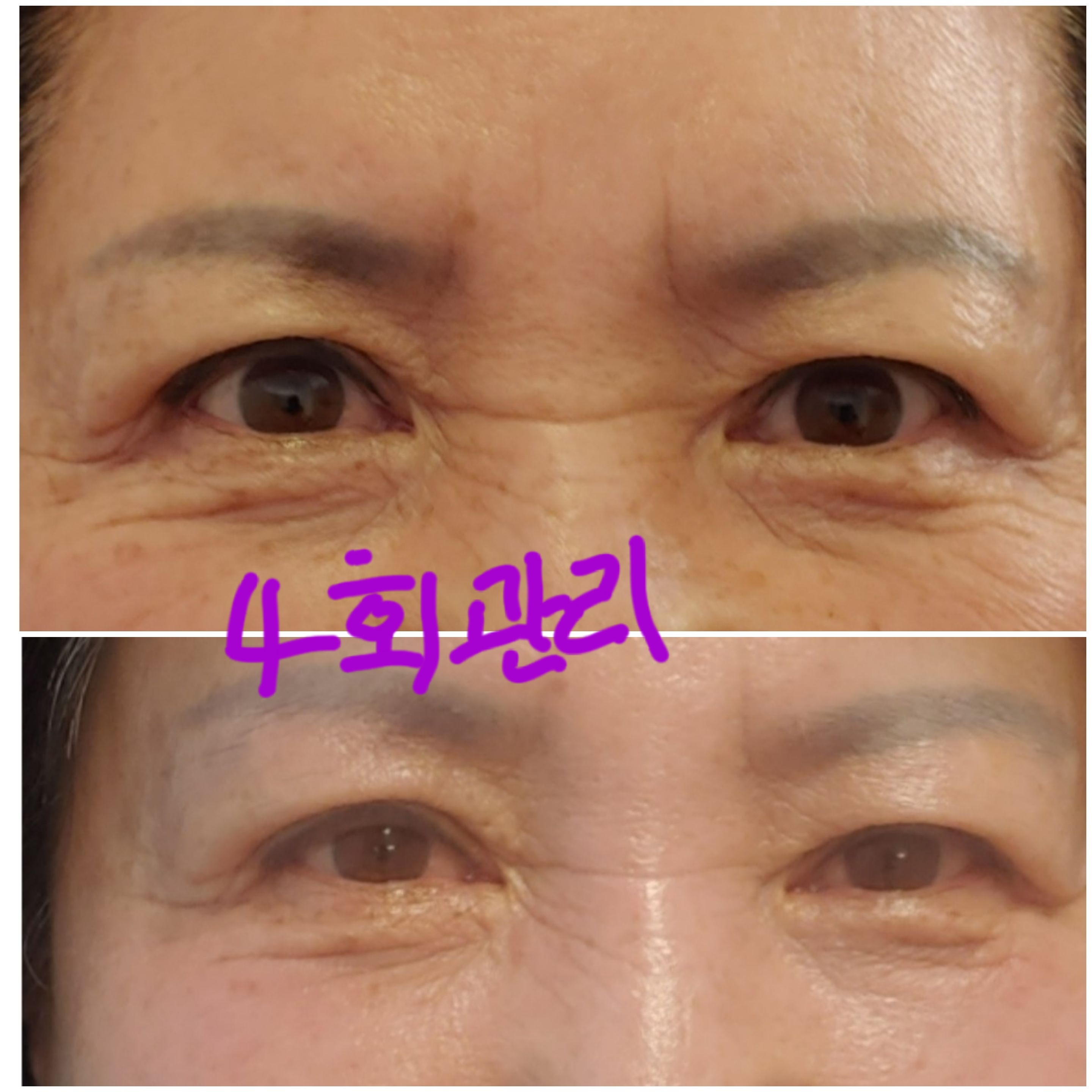 예쁨토탈뷰티샵