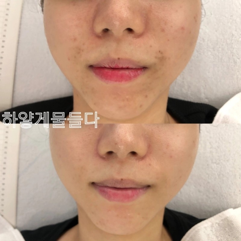 하얗게물들다